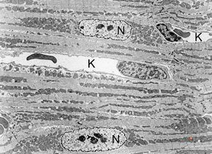  normal myocardium (N … nuclei of cardiomyocytes, K … capillaries)